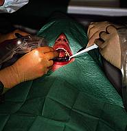 Keimreduzierende Maßnahmen bei oral-chirurgischem Eingriff